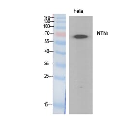 Western blot - Netrin-1 Polyclonal Antibody from Signalway Antibody (41892) - Antibodies.com