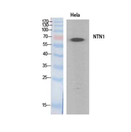 Western blot - Netrin-1 Polyclonal Antibody from Signalway Antibody (41892) - Antibodies.com
