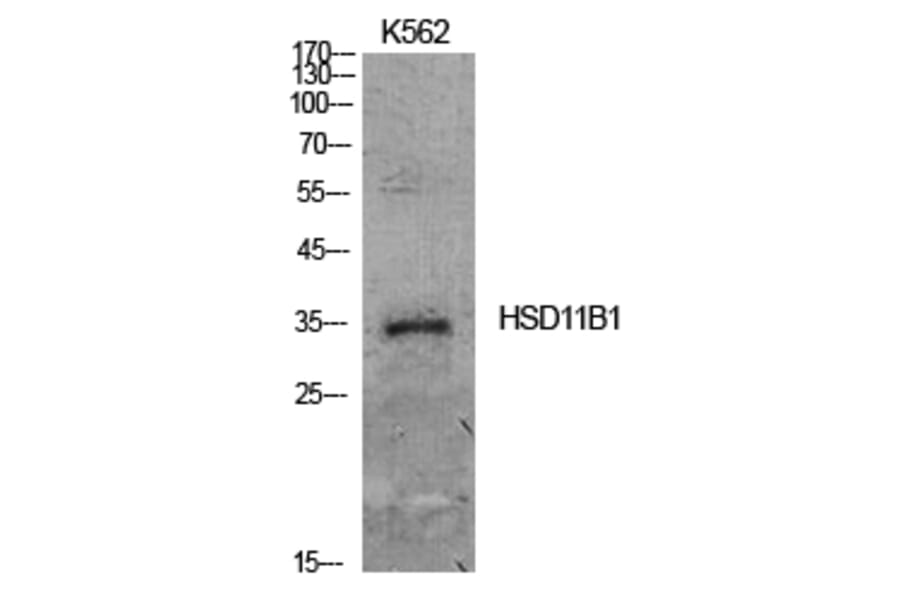 Western blot - 11β-HSD1 Polyclonal Antibody from Signalway Antibody (41926) - Antibodies.com