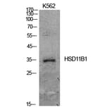 Western blot - 11β-HSD1 Polyclonal Antibody from Signalway Antibody (41926) - Antibodies.com