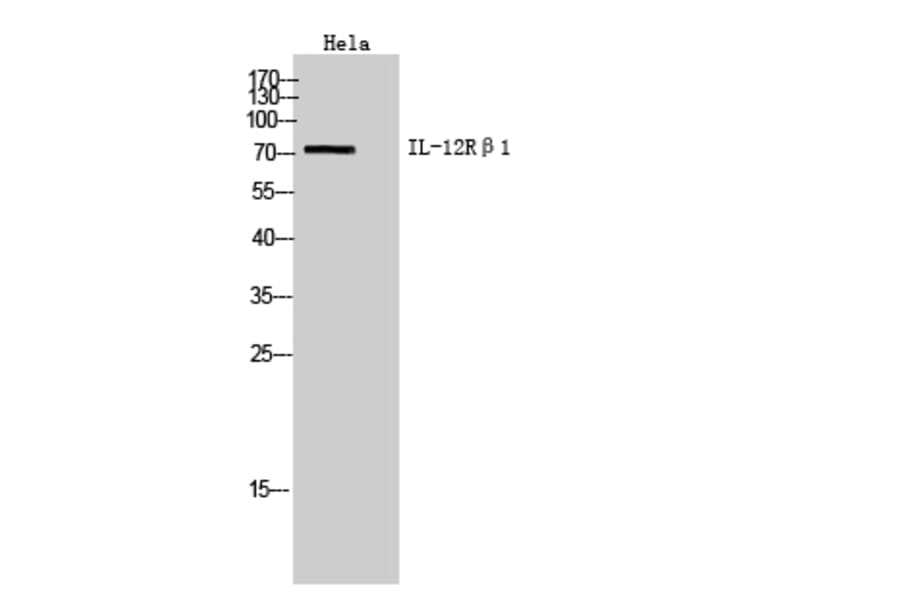 Western blot - IL-12Rβ1 Polyclonal Antibody from Signalway Antibody (41979) - Antibodies.com