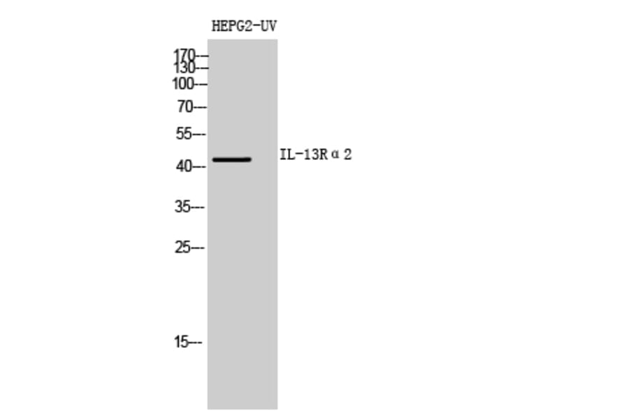 Western blot - IL-13Rα2 Polyclonal Antibody from Signalway Antibody (41981) - Antibodies.com
