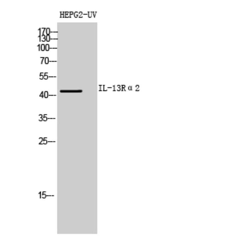 Western blot - IL-13Rα2 Polyclonal Antibody from Signalway Antibody (41981) - Antibodies.com