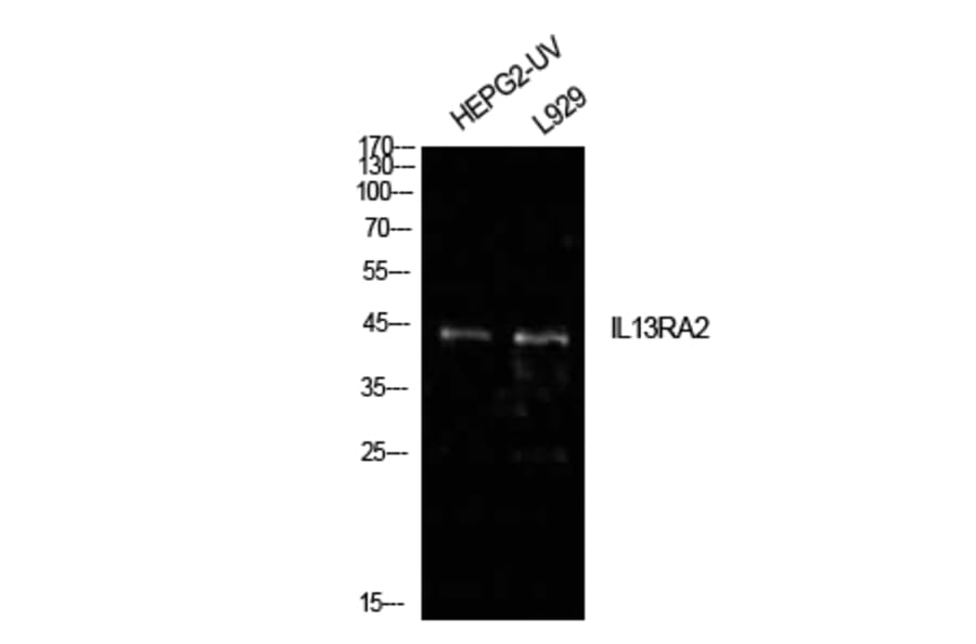 Western blot - IL-13Rα2 Polyclonal Antibody from Signalway Antibody (41981) - Antibodies.com