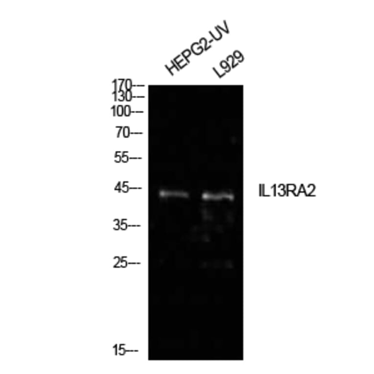 Western blot - IL-13Rα2 Polyclonal Antibody from Signalway Antibody (41981) - Antibodies.com