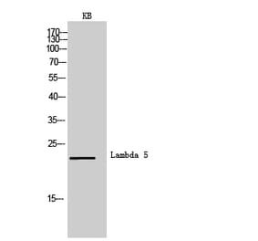 Western blot - Lambda 5 Polyclonal Antibody from Signalway Antibody (42005) - Antibodies.com