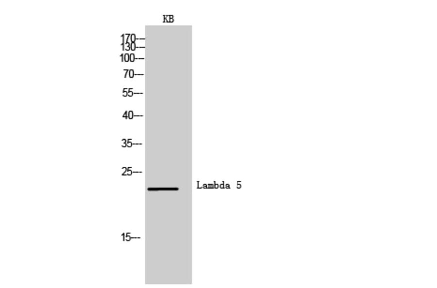 Western blot - Lambda 5 Polyclonal Antibody from Signalway Antibody (42005) - Antibodies.com