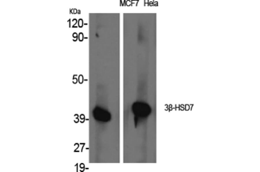 Western blot - 3β-HSD7 Polyclonal Antibody from Signalway Antibody (40527) - Antibodies.com