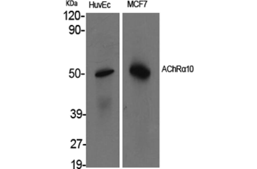 Western blot - AChRα10 Polyclonal Antibody from Signalway Antibody (40542) - Antibodies.com