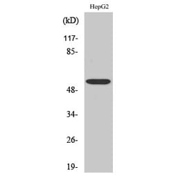 Western blot - ALDH1B1 Polyclonal Antibody from Signalway Antibody (40579) - Antibodies.com
