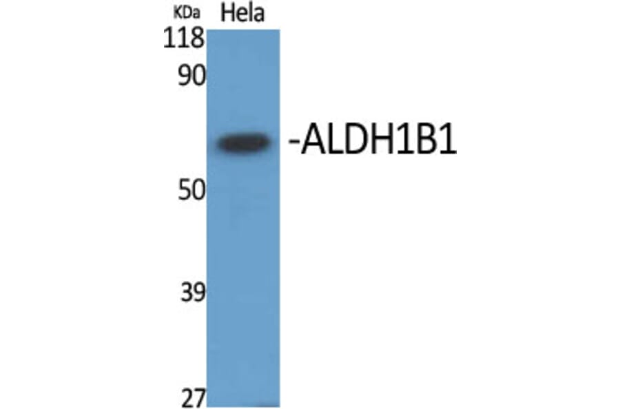 Western blot - ALDH1B1 Polyclonal Antibody from Signalway Antibody (40579) - Antibodies.com