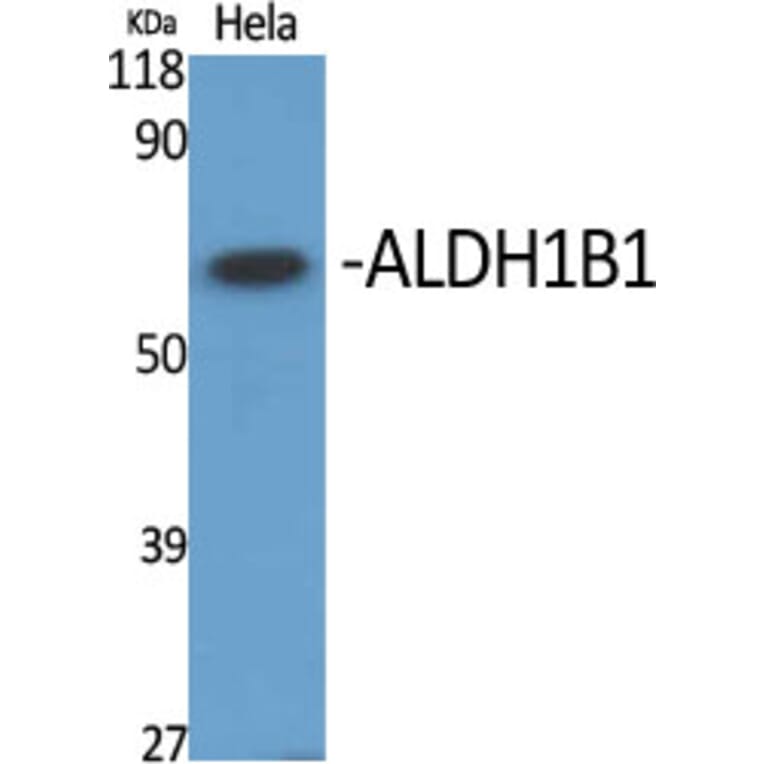 Western blot - ALDH1B1 Polyclonal Antibody from Signalway Antibody (40579) - Antibodies.com