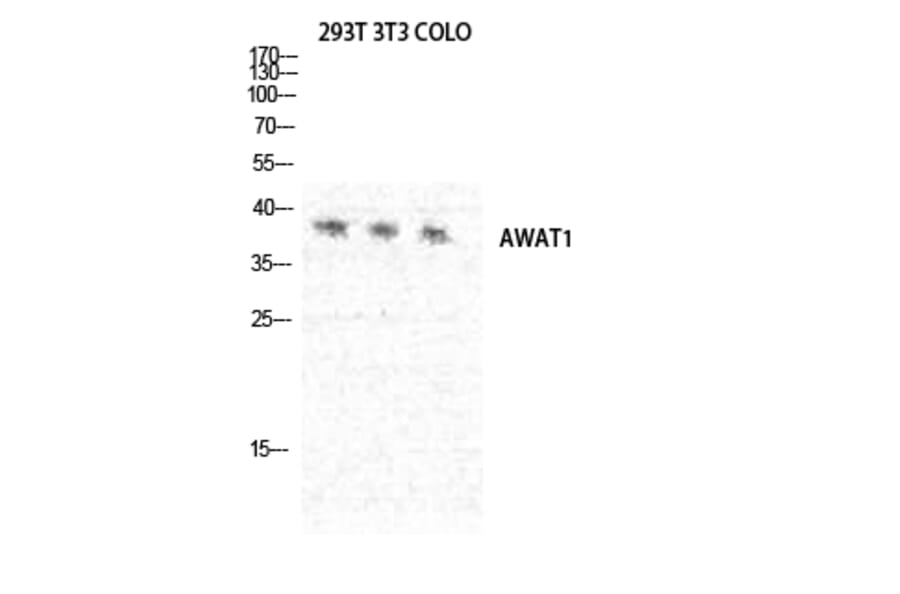 Western blot - DGAT2L3 Polyclonal Antibody from Signalway Antibody (40840) - Antibodies.com