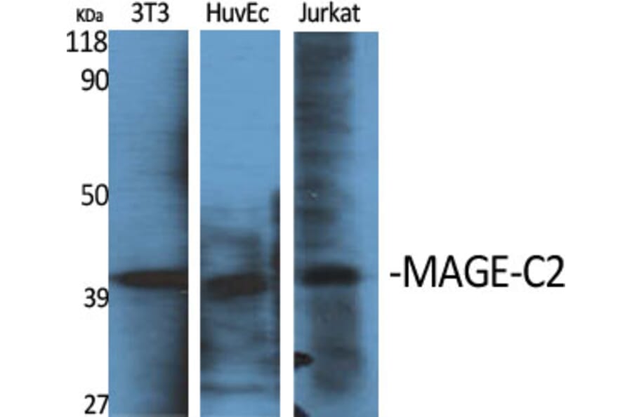 Western blot - MAGE-C2 Polyclonal Antibody from Signalway Antibody (41119) - Antibodies.com