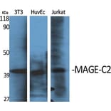 Western blot - MAGE-C2 Polyclonal Antibody from Signalway Antibody (41119) - Antibodies.com