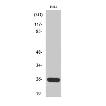Western blot - MRP-S34 Polyclonal Antibody from Signalway Antibody (41182) - Antibodies.com