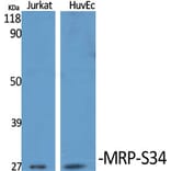 Western blot - MRP-S34 Polyclonal Antibody from Signalway Antibody (41182) - Antibodies.com