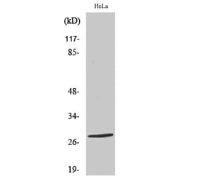 Western blot - Nkx-2.6 Polyclonal Antibody from Signalway Antibody (41244) - Antibodies.com