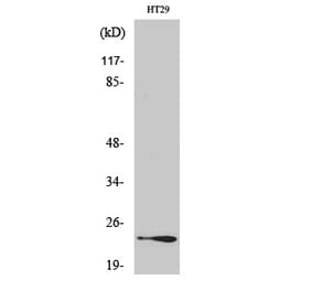 Western blot - Rab 7L1 Polyclonal Antibody from Signalway Antibody (41379) - Antibodies.com