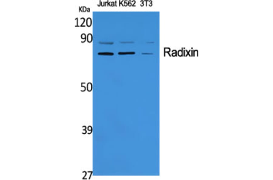 Western blot - Radixin Polyclonal Antibody from Signalway Antibody (41382) - Antibodies.com
