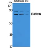 Western blot - Radixin Polyclonal Antibody from Signalway Antibody (41382) - Antibodies.com