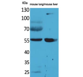 Western blot - ALDH1A1 Polyclonal Antibody from Signalway Antibody (41570) - Antibodies.com
