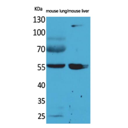 Western blot - ALDH1A1 Polyclonal Antibody from Signalway Antibody (41570) - Antibodies.com
