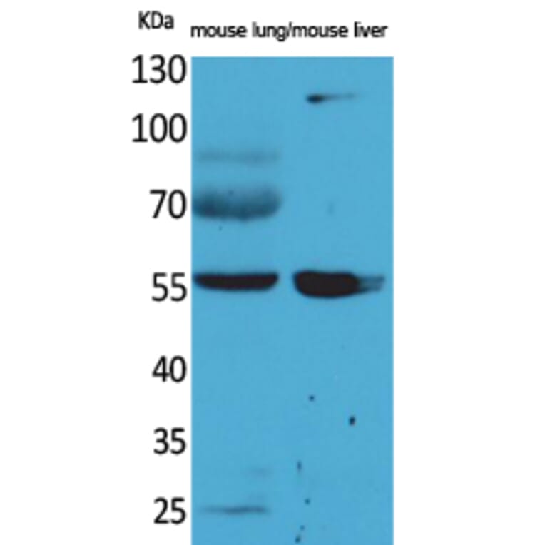 Western blot - ALDH1A1 Polyclonal Antibody from Signalway Antibody (41570) - Antibodies.com