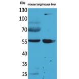 Western blot - ALDH1A1 Polyclonal Antibody from Signalway Antibody (41570) - Antibodies.com