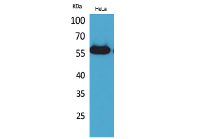 Western blot - Amylase Polyclonal Antibody from Signalway Antibody (41575) - Antibodies.com