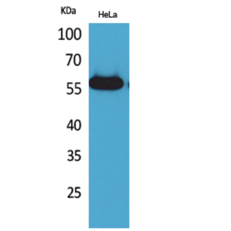 Western blot - Amylase Polyclonal Antibody from Signalway Antibody (41575) - Antibodies.com