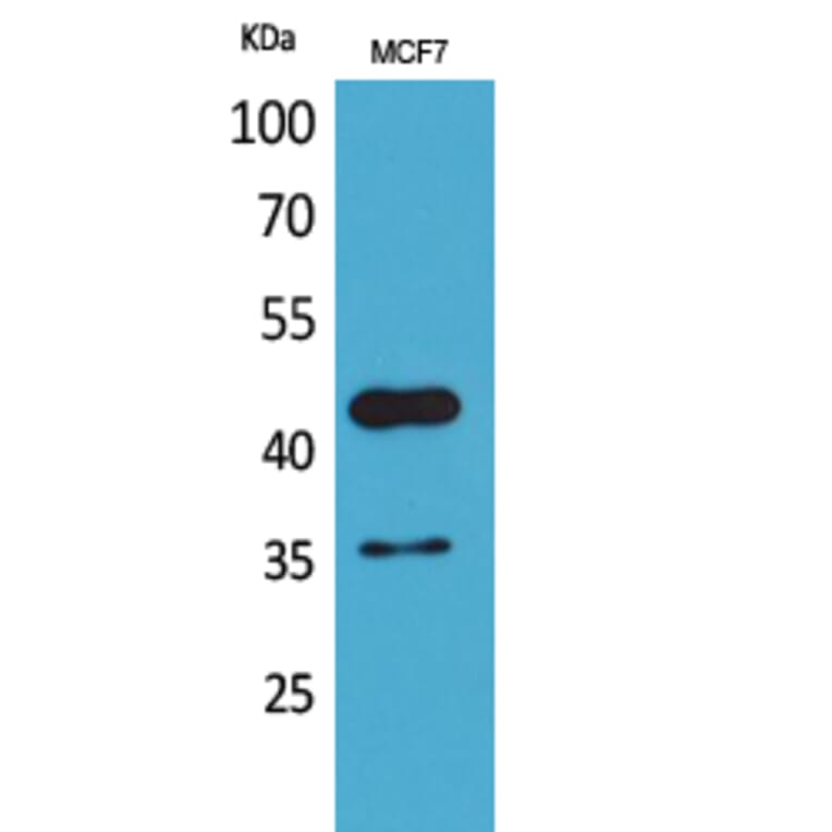 Western blot - Angptl4 Polyclonal Antibody from Signalway Antibody (41583) - Antibodies.com