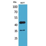 Western blot - Angptl4 Polyclonal Antibody from Signalway Antibody (41583) - Antibodies.com