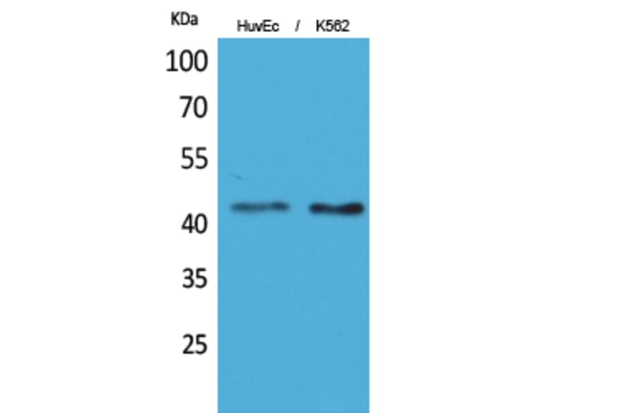 Western blot - Layilin Polyclonal Antibody from Signalway Antibody (41630) - Antibodies.com