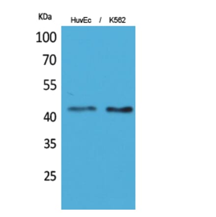 Western blot - Layilin Polyclonal Antibody from Signalway Antibody (41630) - Antibodies.com