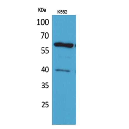 Western blot - CYP11A1 Polyclonal Antibody from Signalway Antibody (41631) - Antibodies.com