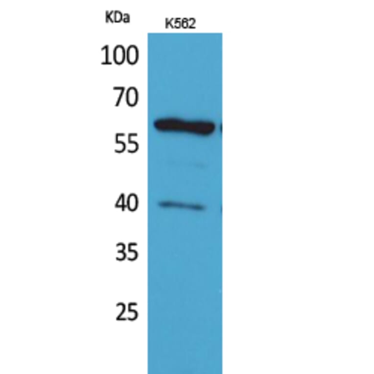 Western blot - CYP11A1 Polyclonal Antibody from Signalway Antibody (41631) - Antibodies.com