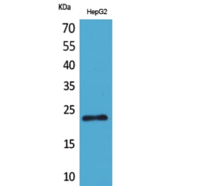 Western blot - SNAP 23 Polyclonal Antibody from Signalway Antibody (41639) - Antibodies.com
