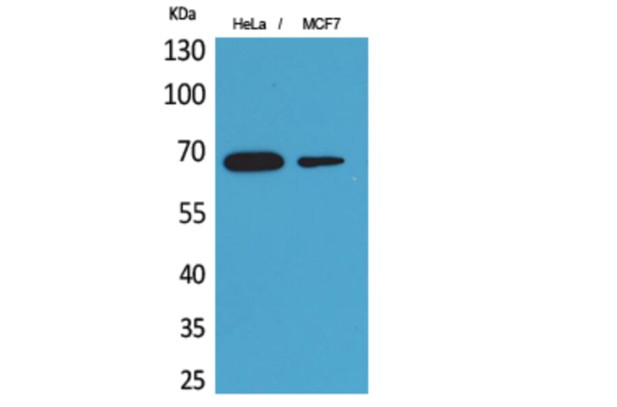 Western blot - PEPCK-C Polyclonal Antibody from Signalway Antibody (41644) - Antibodies.com