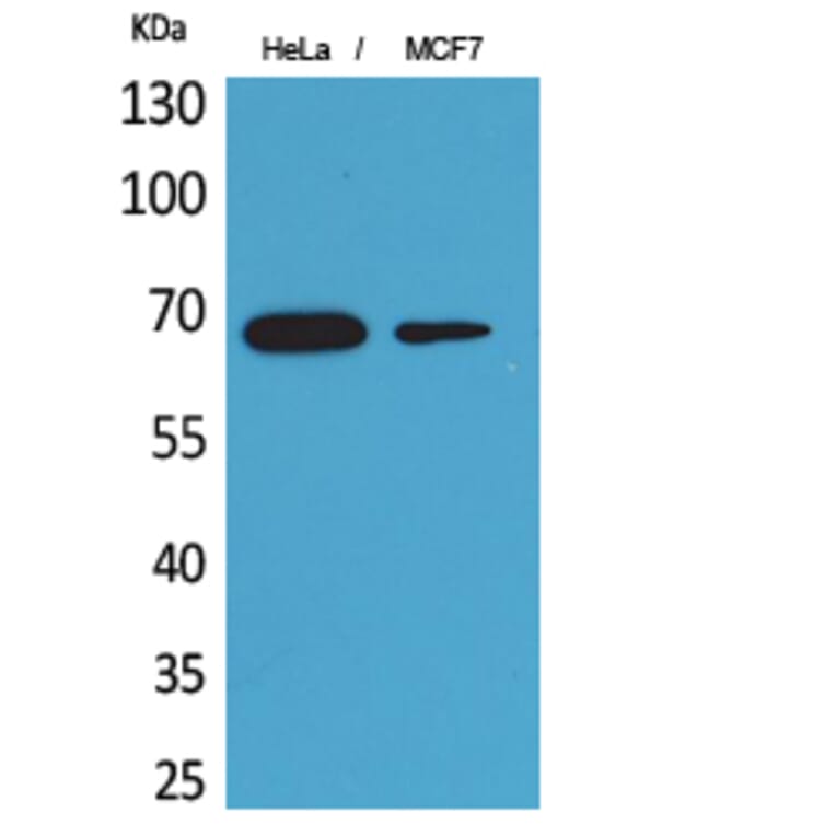 Western blot - PEPCK-C Polyclonal Antibody from Signalway Antibody (41644) - Antibodies.com