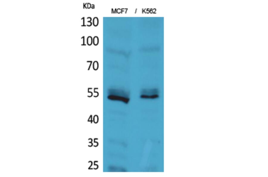 Western blot - CD85e/h Polyclonal Antibody from Signalway Antibody (41664) - Antibodies.com