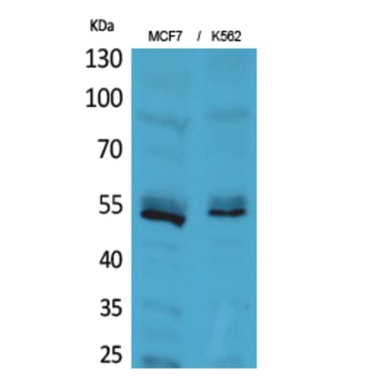 Western blot - CD85e/h Polyclonal Antibody from Signalway Antibody (41664) - Antibodies.com