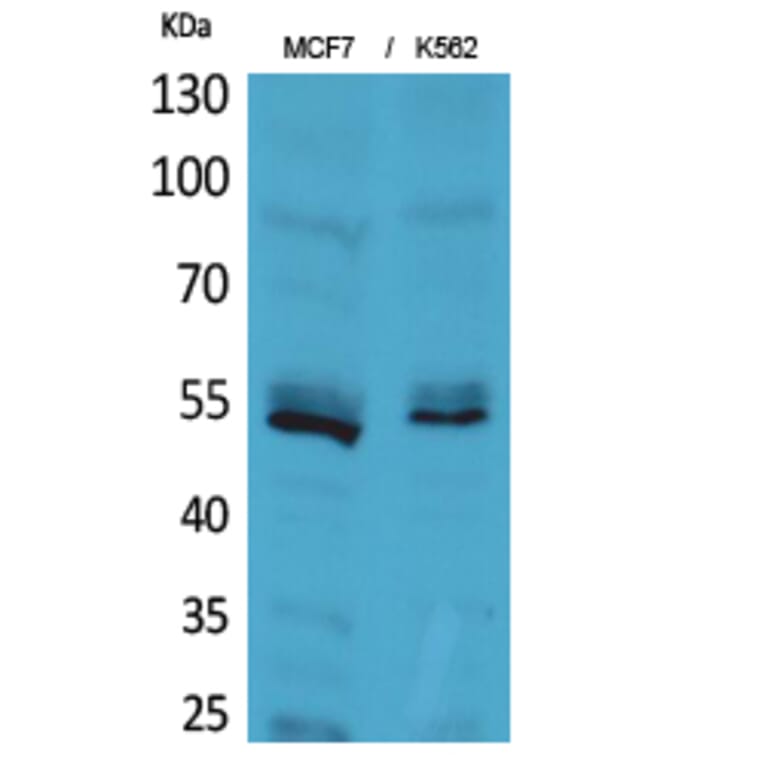 Western blot - CD85e/h Polyclonal Antibody from Signalway Antibody (41664) - Antibodies.com