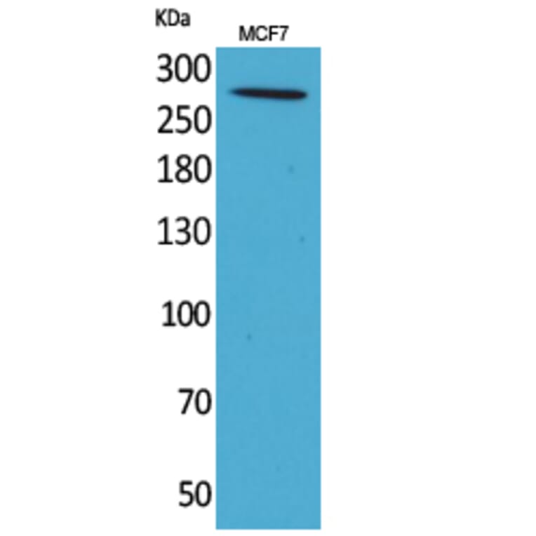 Western blot - IGF-IIR Polyclonal Antibody from Signalway Antibody (41676) - Antibodies.com
