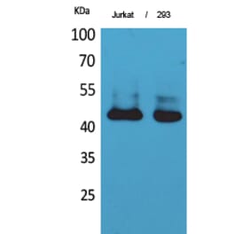 Western blot - SCCA1/2 Polyclonal Antibody from Signalway Antibody (41712) - Antibodies.com