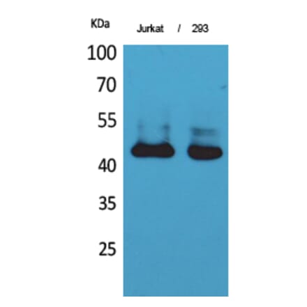 Western blot - SCCA1/2 Polyclonal Antibody from Signalway Antibody (41712) - Antibodies.com