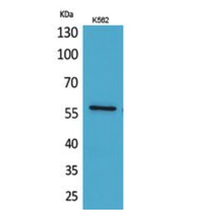 Western blot - Angptl1 Polyclonal Antibody from Signalway Antibody (41752) - Antibodies.com