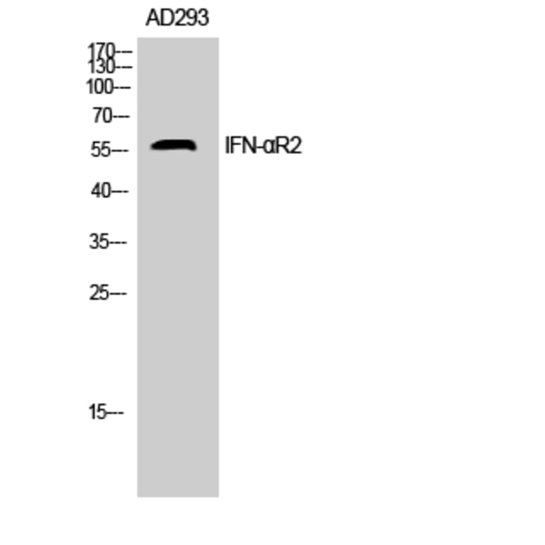 Western blot - IFN-αR2 Polyclonal Antibody from Signalway Antibody (41754) - Antibodies.com