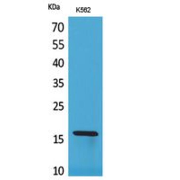 Western blot - CRBP II Polyclonal Antibody from Signalway Antibody (41773) - Antibodies.com