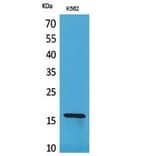 Western blot - CRBP II Polyclonal Antibody from Signalway Antibody (41773) - Antibodies.com